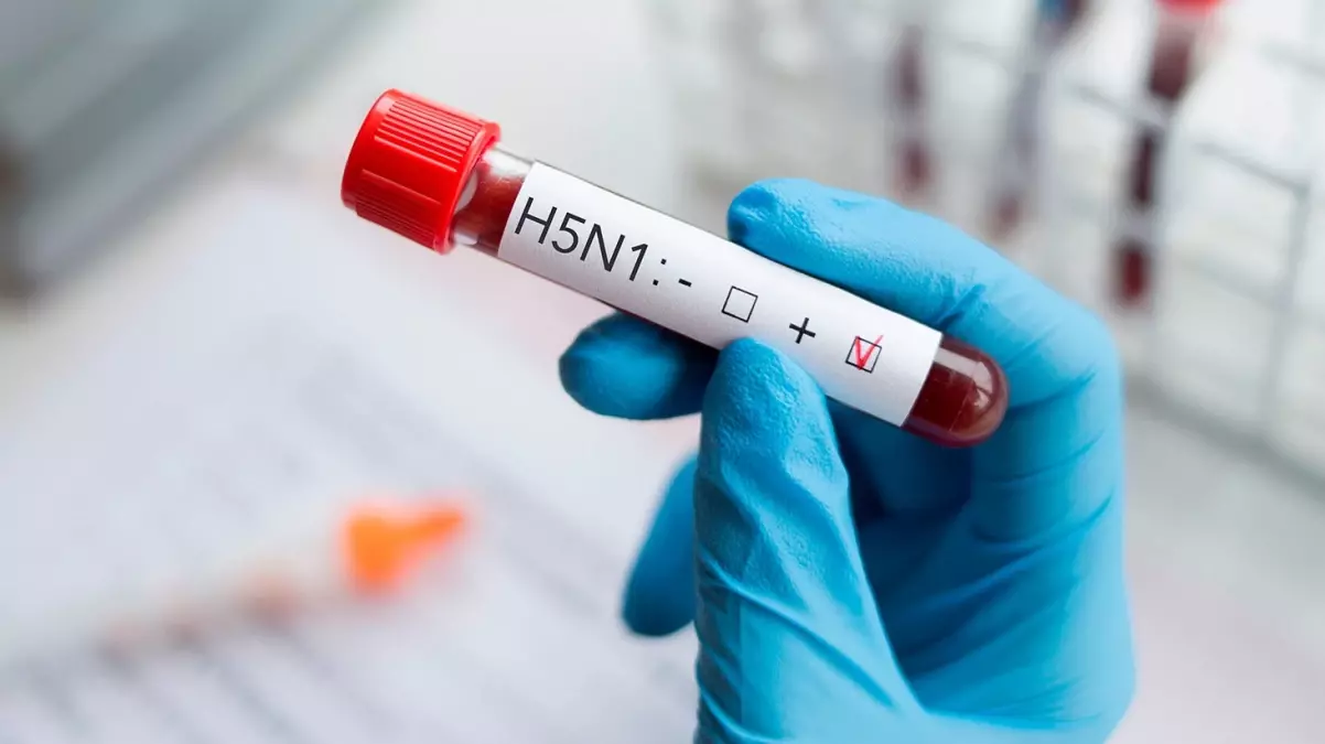 Profesörden infial yaratacak iddia: İstanbul Tıp Fakültesi’nde HIV pozitif 100 çocuk var